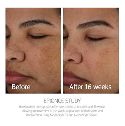 Epionce Melanolyte TX 30 ml